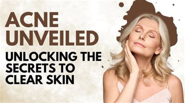 Unlocking The Secrets To Clear Skin